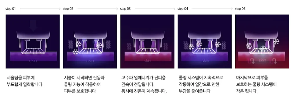 아큐렙 기술